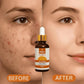 Relax Vitamin C Daily Face Serum - Anti-Aging Face Serum - 30ml